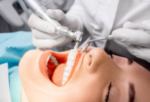 Understanding Porcelain Veneers Cost in Sydney: A Complete Patient Guide