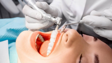 Understanding Porcelain Veneers Cost in Sydney: A Complete Patient Guide